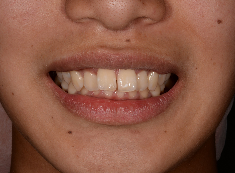 Before