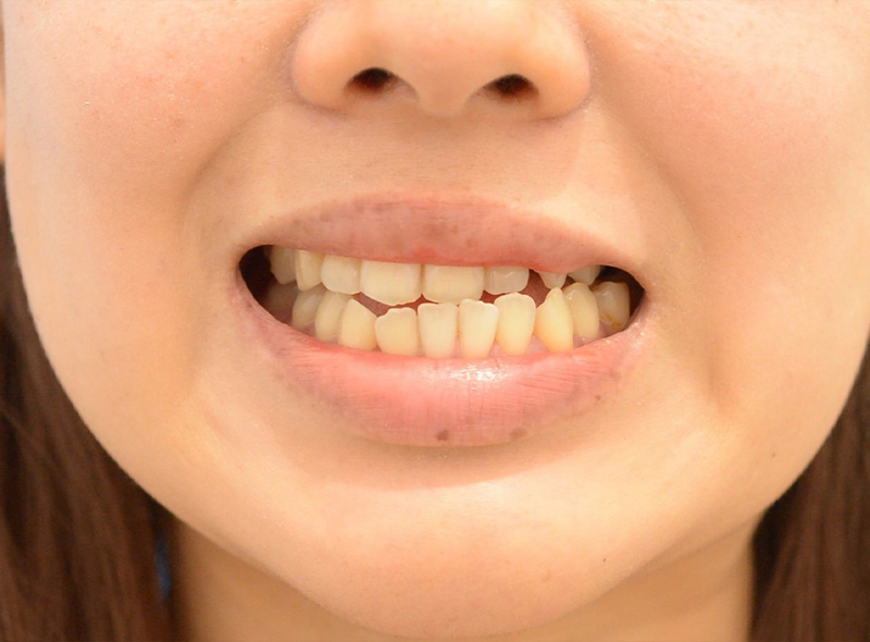 Before